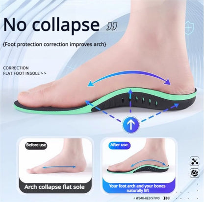 【2 Pairs】Advanced Orthotic Arch Support Insoles for Flat Feet & Pain Relief - BPRunning