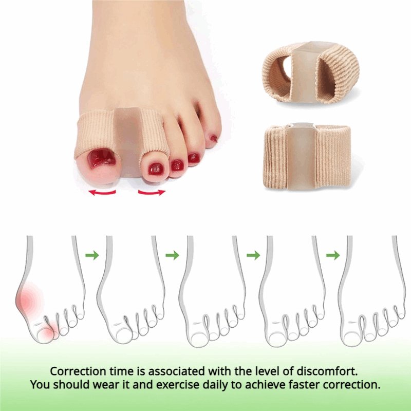 (2 Pcs) Gel Bunion Toe Separators - Breathable Protectors for Overlapping Toes - BPRunning